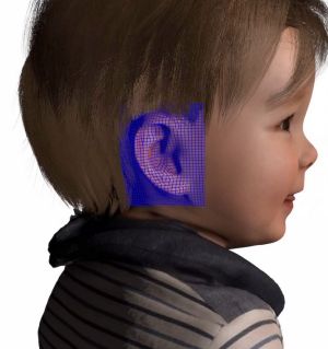 Modelling of a 3D-printed ear for a toddler with microtia.jpg